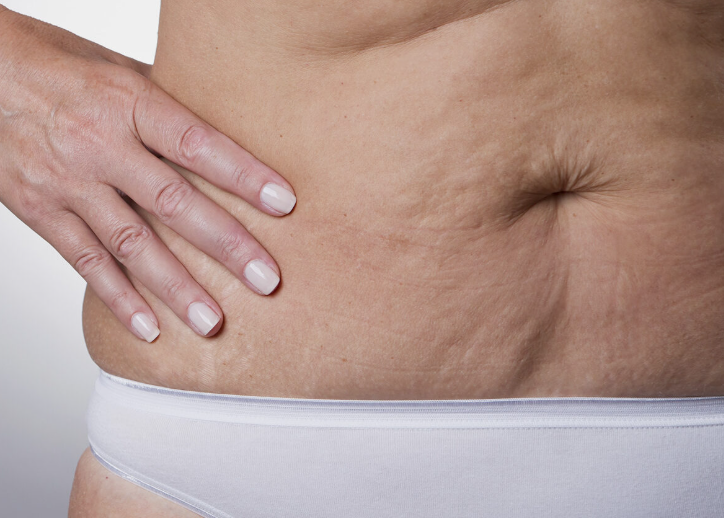 Cuidado de la piel 3